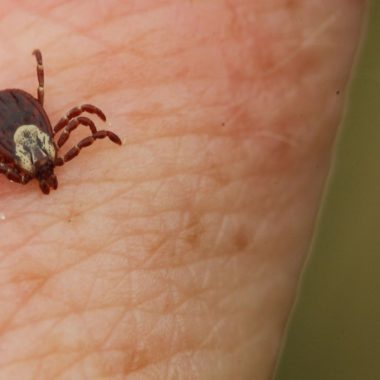 A tick on a person's skin.